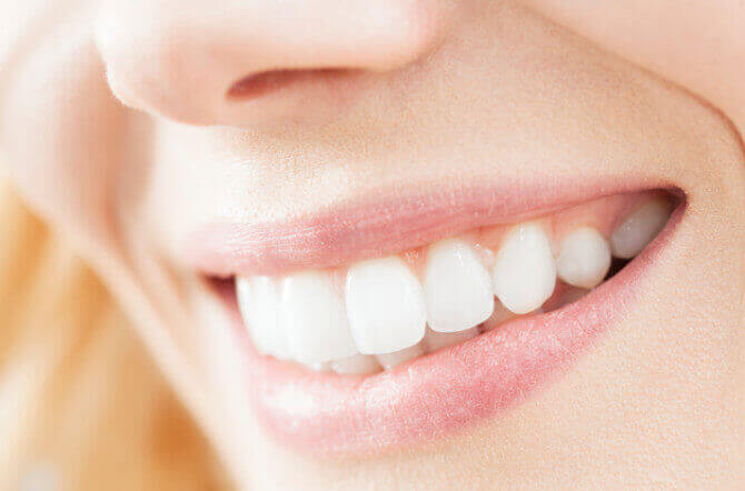 5 Secrets to Whiter Teeth