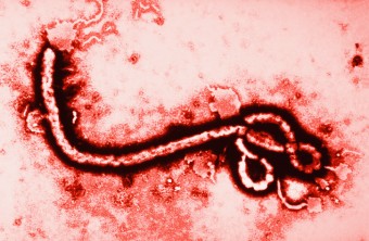 What Are the Ebola Virus Effects?