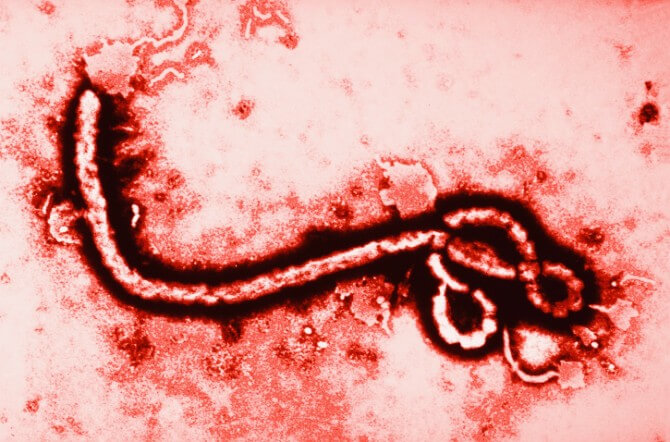 Ebola Virus at 108,000 Magnification