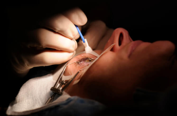 Lasik Vision Correction Surgery
