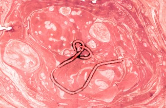 A Brief History of the Ebola Virus