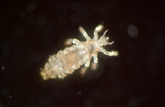 What Are Head Lice? Six Quick Facts