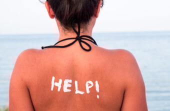Sunburned? What to Do & When to Seek Help